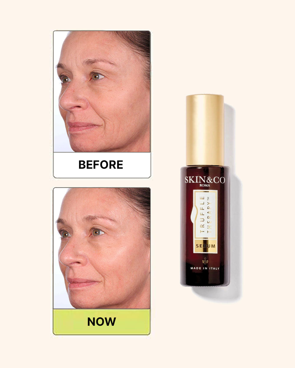 Truffle Therapy Age-Defense Serum